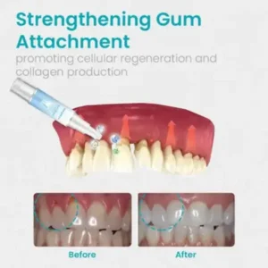 NESLEMY™ Gum Shield Therapy Gel 2025