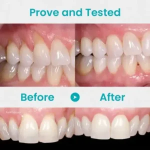 NESLEMY™ Gum Shield Therapy Gel 2025