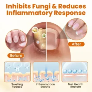Timilk® FungiBee Advanced Nail Repair Spray