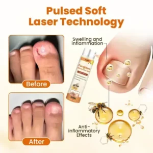 Timilk® FungiBee Advanced Nail Repair Spray